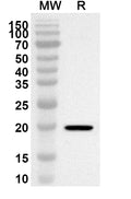 Western blot analysis was performed using anti-Mouse GLI2 polyclonal antibody at 1ug/mL on recombinant Mouse GLI2 (Catalog No. MY480012).