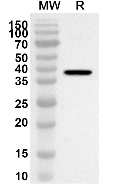 Western blot analysis was performed using anti-Mouse CD79α/CD79A polyclonal antibody at 1ug/mL on recombinant Mouse CD79α/CD79A (Catalog No. MY570012).
