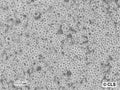 Meth A sarcoma cell