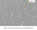 Human Induced Neural Stem Cells (HiNSC-DLK) | Applied Biological Materials (abm)