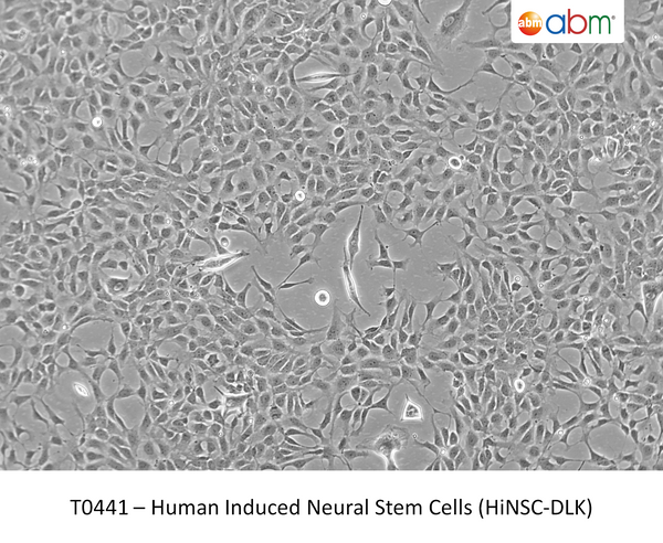 Human Induced Neural Stem Cells (HiNSC-DLK) | Applied Biological Materials (abm)