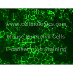 Immortalized GFP-Expressing Mouse Primary Esophageal Epithelial Cells product image
