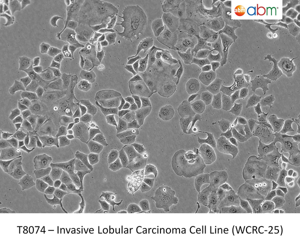 Invasive Lobular Carcinoma Cell Line (WCRC-25) | Applied Biological Materials (abm)