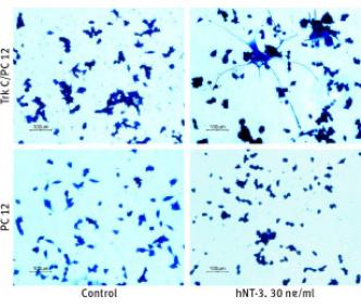 Recombinant human Neurotrophin-3 (NT-3) protein