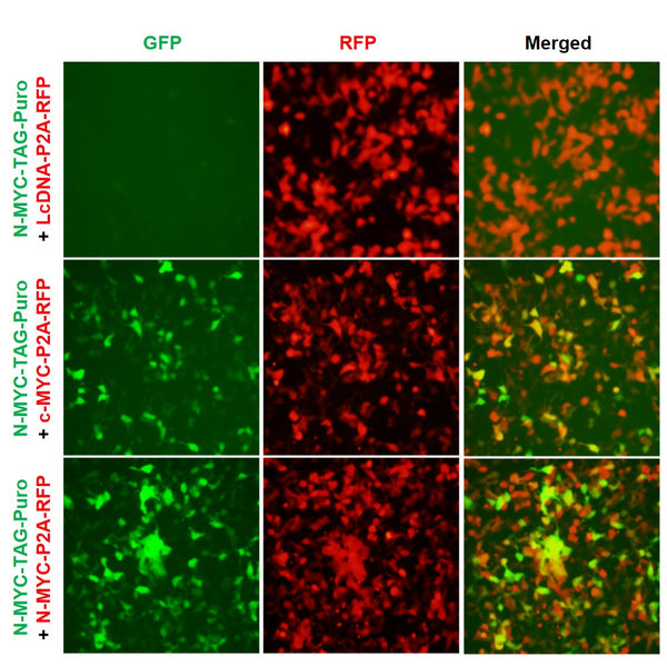 N-MYC Reporter Lentivirus – Figure 1