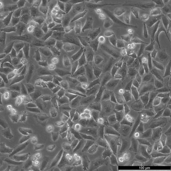 NCI-H1703 cell