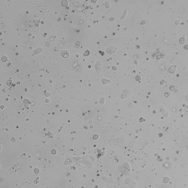 NCI-H1781 cell