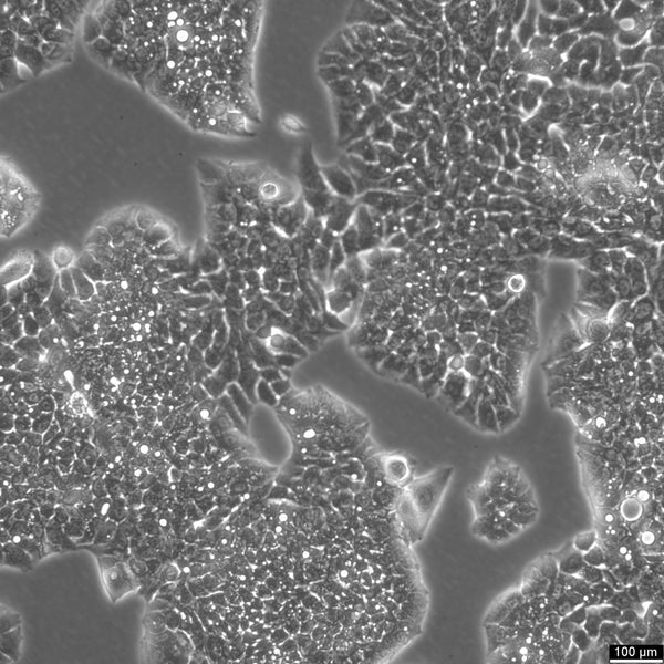 NCI-H1944 cell