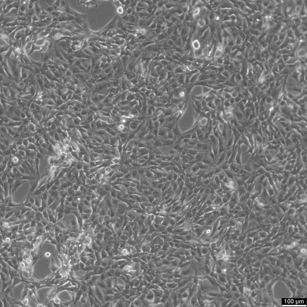 NCI-H1975 cell