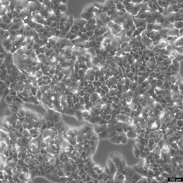 NCI-H2126 cell