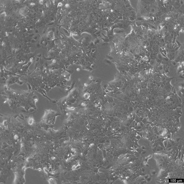 NCI-H2170 cell