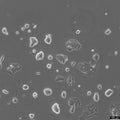 NCI-H2195 cell