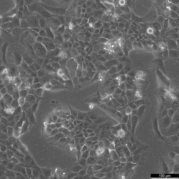 NCI-H2228 cell