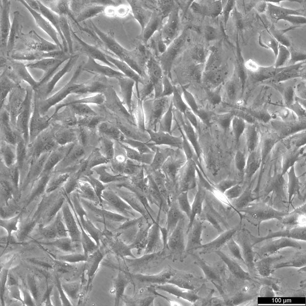 NCI-H2452 cell