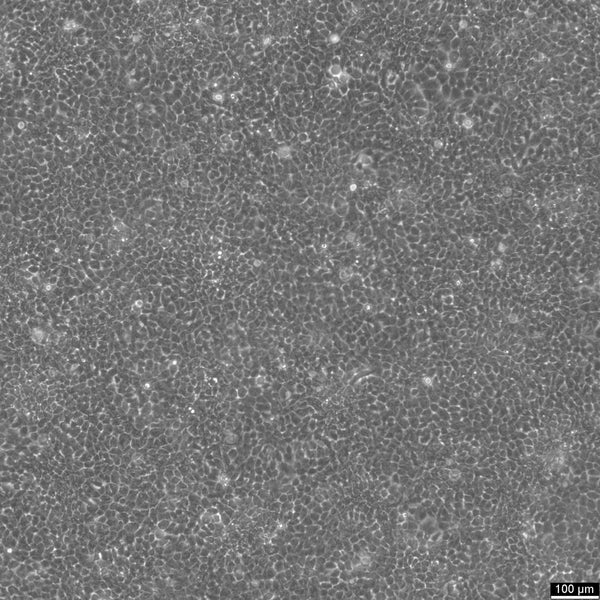 NCI-H292 cell