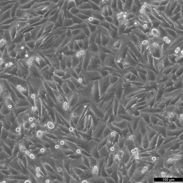 NCI-H647 cell