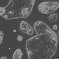 NCI-N87 cell