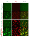NFE2 Reporter Lentivirus – Figure 1 of 2