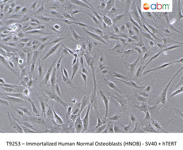 Immortalized Human Normal Osteoblasts (HNOB) - SV40 + hTERT | Applied Biological Materials (abm)