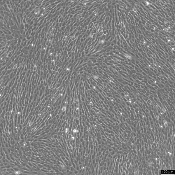 NRK cell