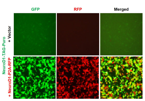 NeuroD1 Reporter Lentivirus – Figure 1