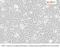 Mouse Cannabinoid Receptor 1 Stably Expressing HEK293 Cell Line (mCB1) | Applied Biological Materials (abm)