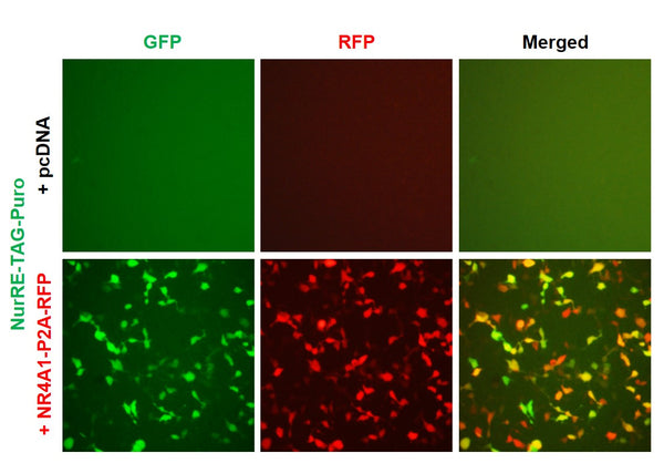 NurRE Reporter Lentivirus – Figure 1 of 7