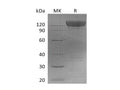 Recombinant Mouse PDGFRa/CD140a Protein (Fc Tag) – Figure 1 of 2