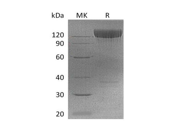 Recombinant Mouse PDGFRa/CD140a Protein (Fc Tag) – Figure 1 of 2