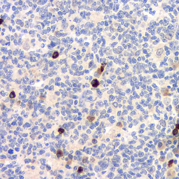 CD284 Polyclonal Antibody – Figure 1 of 5