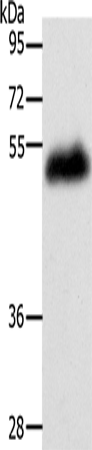 LOX Polyclonal Antibody – Figure 1 of 3