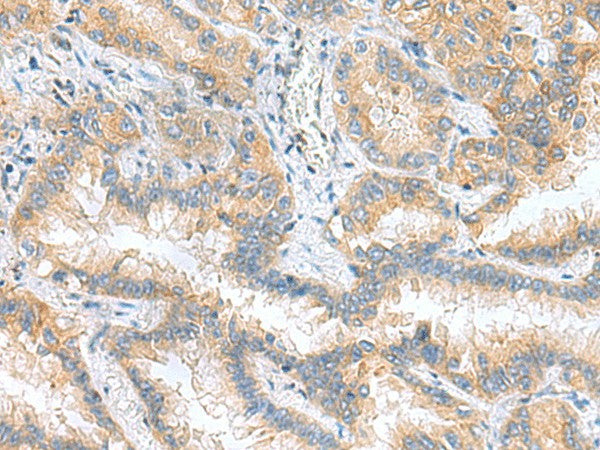 RPS16 Polyclonal Antibody – Figure 1 of 3