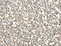MAGEA1 Polyclonal Antibody – Figure 1 of 3