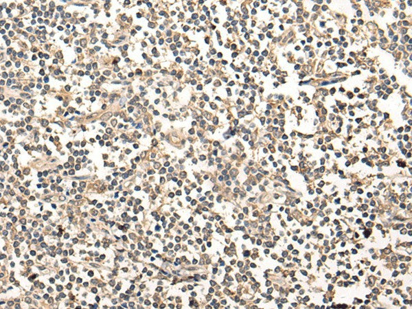 MAGEA1 Polyclonal Antibody – Figure 1 of 3