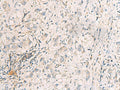 SUSD3 Polyclonal Antibody – Figure 1 of 2