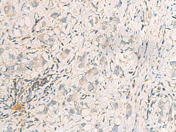 SUSD3 Polyclonal Antibody – Figure 1 of 2