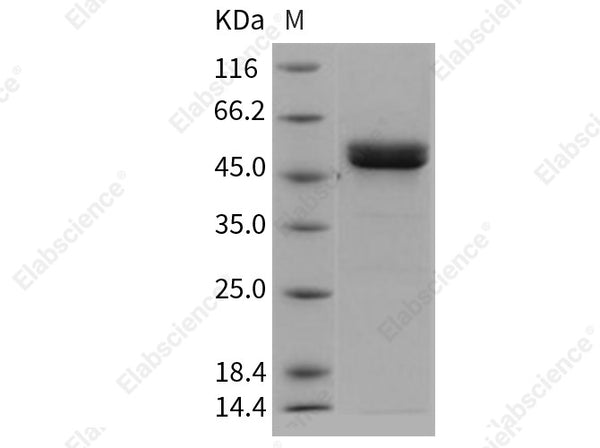 Recombinant Human MMP1 Protein (His Tag) - Figure 1 of 2
