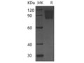 Recombinant Mouse PDGFRa/CD140a Protein (His Tag) – Figure 1 of 2
