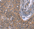 IL3RB Polyclonal Antibody – Figure 1 of 3