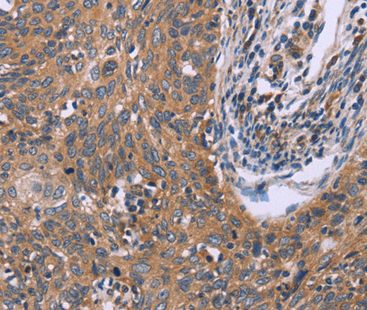 IL3RB Polyclonal Antibody – Figure 1 of 3