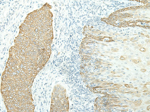 ETAA1 Polyclonal Antibody – Figure 1 of 3