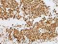 RBM12 Polyclonal Antibody – Figure 1 of 3