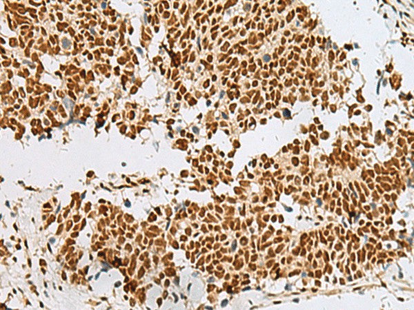 RBM12 Polyclonal Antibody – Figure 1 of 3