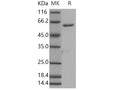 Recombinant Human ROR1 Protein (aa 453-783, His & GST Tag) – Figure 1 of 2