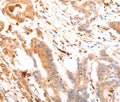 ABCA4 Polyclonal Antibody – Figure 1 of 3