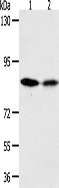ADAM11 Polyclonal Antibody – Figure 1 of 4
