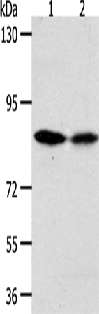 ADAM11 Polyclonal Antibody – Figure 1 of 4