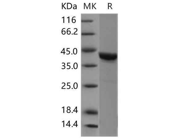 Recombinant Mouse CSNK2A1/CK2A1 Protein – Figure 1 of 2