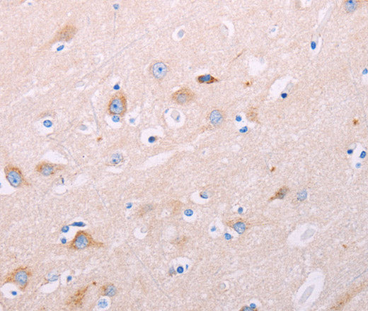 ADCY5 Polyclonal Antibody – Figure 1 of 3