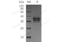 Recombinant Human LTBR/TNFRSF3 Protein (His Tag) – Figure 1 of 2